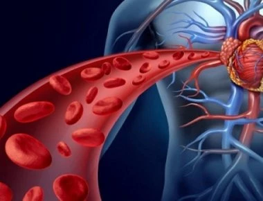 20 Τρόφιμα που αποφράσσουν με φυσικό τρόπο τις αρτηρίες